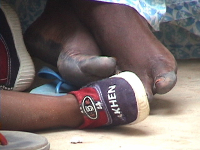 Feet